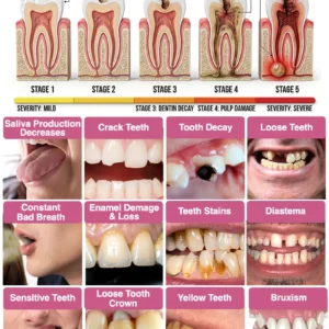 Alternative view of Mrypek® DenPerm Cavity-Repair Natural Enamel Filling Gel